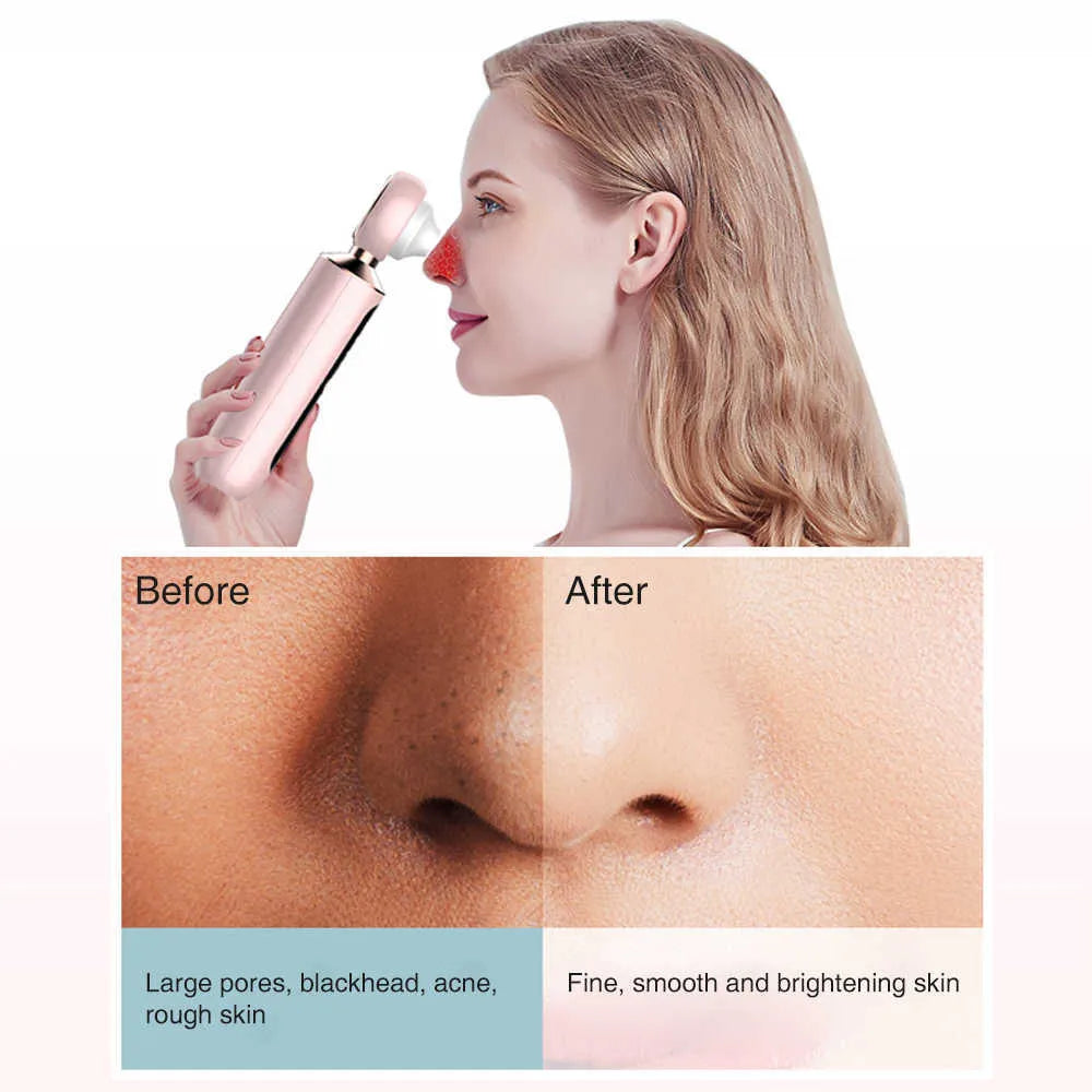 𝘼𝙈𝘼𝙉𝘼𝙃™ Blackhead Suction Machine