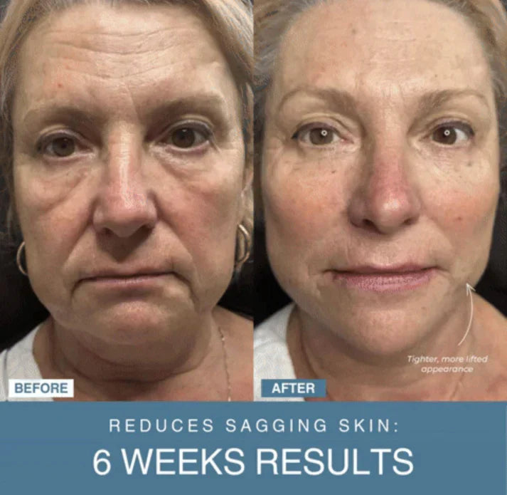 𝘼𝙈𝘼𝙉𝘼𝙃™ 7-in-1 LED Anti-Aging/Wrinkle Apparatus