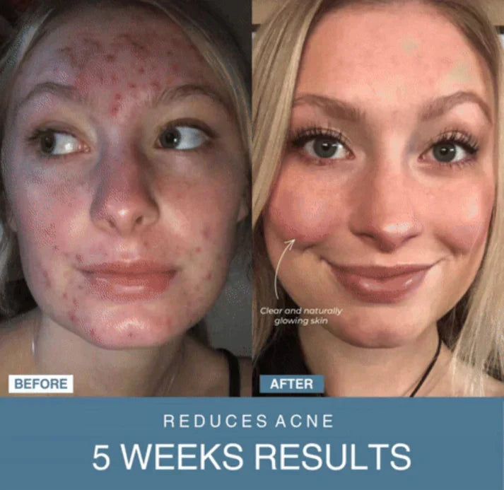 𝘼𝙈𝘼𝙉𝘼𝙃™ 7-in-1 LED Anti-Aging/Wrinkle Apparatus